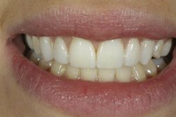 Стоматологическая клиника Вита-Дент, с рейтингом 2.8 - находится по адресу Брянск, улица Медведева, 5 