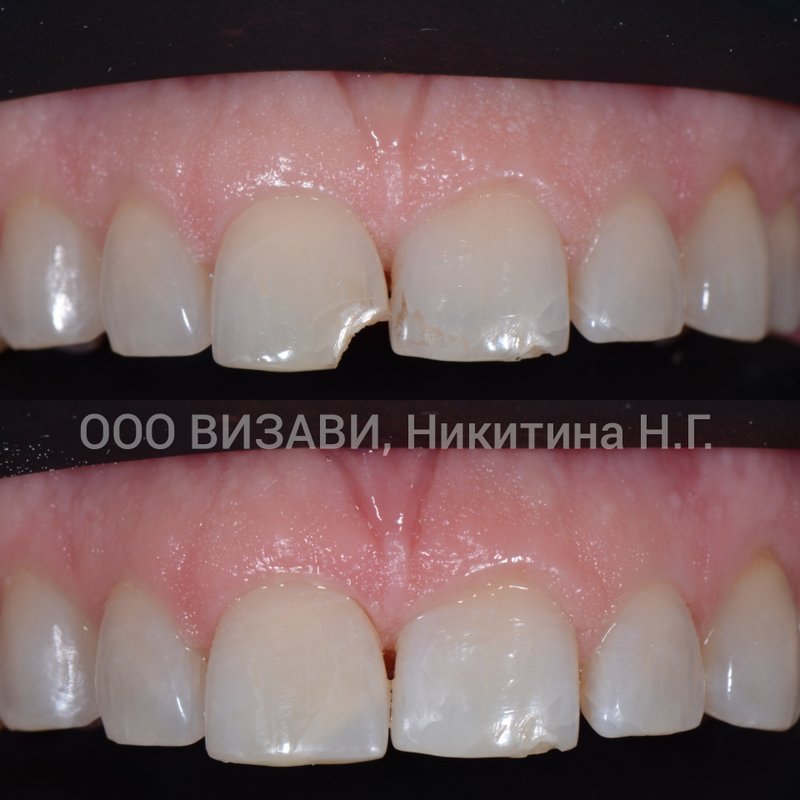 фотография работы Стоматологической клиники Визави в переулке Первостроителей в Кстово, 