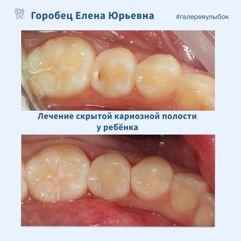 фотография работы Цифровой стоматологии ДоДоктор в Луговом