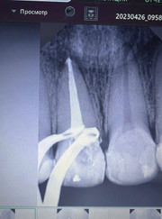 Стоматолог, стоматолог-терапевт Елизавета Ашотовна Мякишева