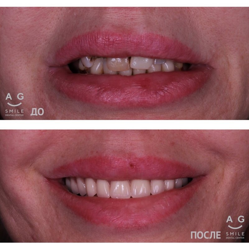 фотография работы Стоматологии AG-Smile на Новой Басманной улице