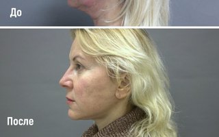 фотография работы врача Валерия Геннадьевича Золотых