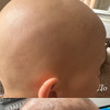 фото от пользователя Анаит в отзыве о клинике Доктора Ундрицова в Пресненском районе