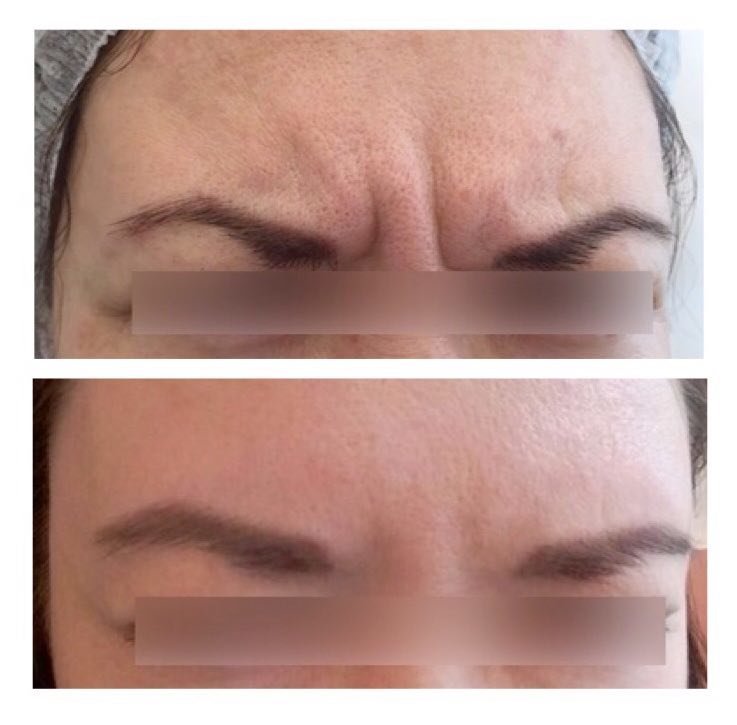 фотография работы Центра медицинской косметологии Beauty Сlub на Школьной улице