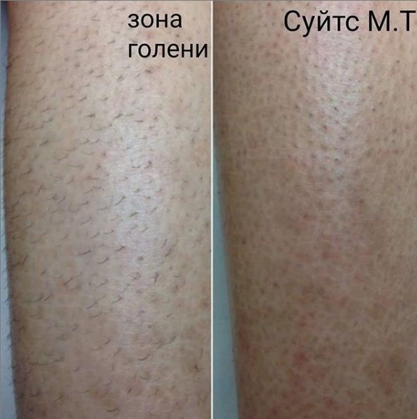 фотография работы Центра эстетической медицины и лазерной косметологии Мед Эстетик