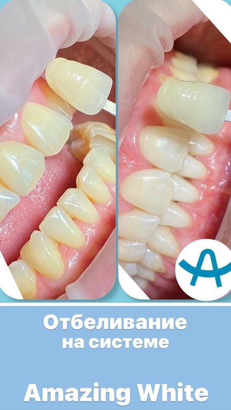 фотография работы Стоматологической клиники Альбус на улице Чернышевского