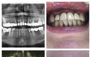 фотография работы врача Габриэля Михайловича Хамицева