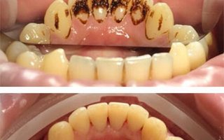 фотография работы врача Ирины Викторовны Бекаевой