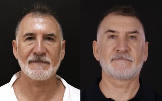 фотография работы врача Андрея Евгеньевича Копасова