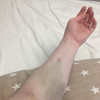 фото от пользователя Анна в отзыве о медицинском центре YourMed на метро Мякинино в Красногорске