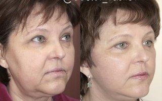 фотография работы врача Дмитрия Олеговича Васильева