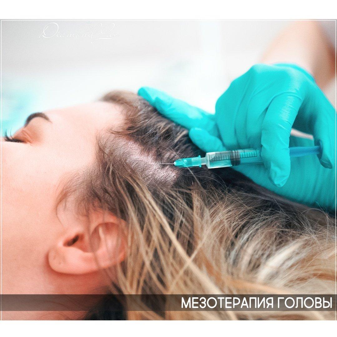 мезотерапия для волос фото