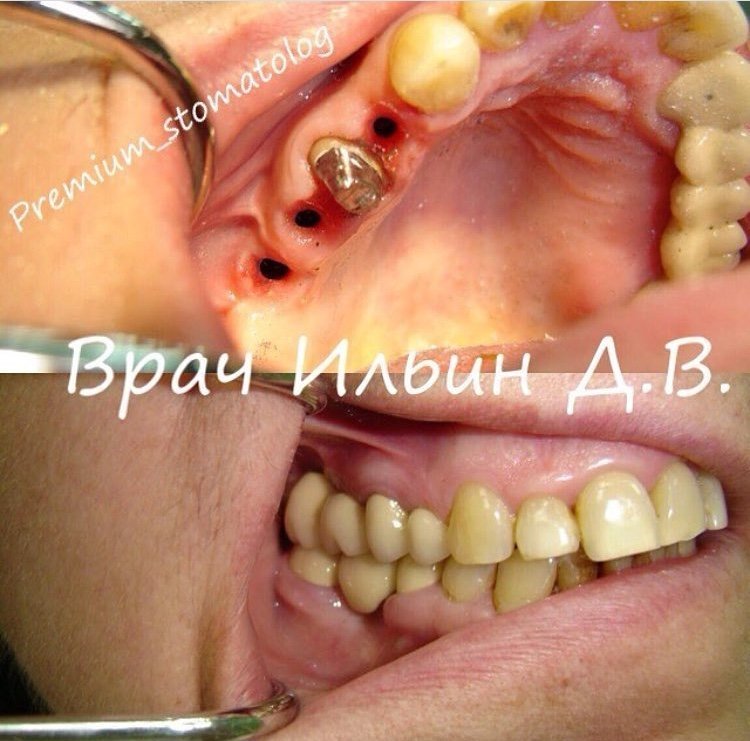 фотография работы Стоматологической клиники Дент престиж в Южном Бутово