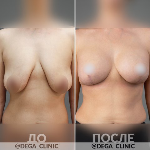 фотография работы Клиники эстетической медицины DEGA в Невском районе
