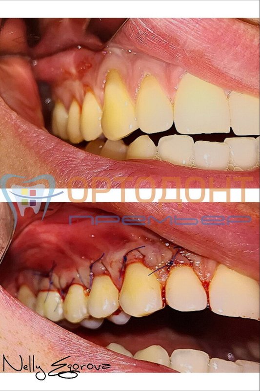 фотография работы Клиники эстетической стоматологии и косметологии Артукова на проспекте Мира