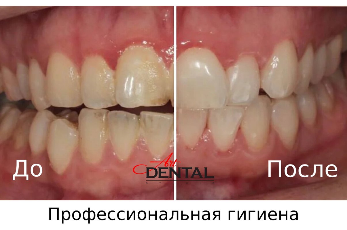 фотография работы Стоматологии Art Dental Studio на улице Маршала Тухачевского, 58 к 3