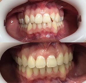 фотография работы Стоматологической клиники Архидент в Измайлово