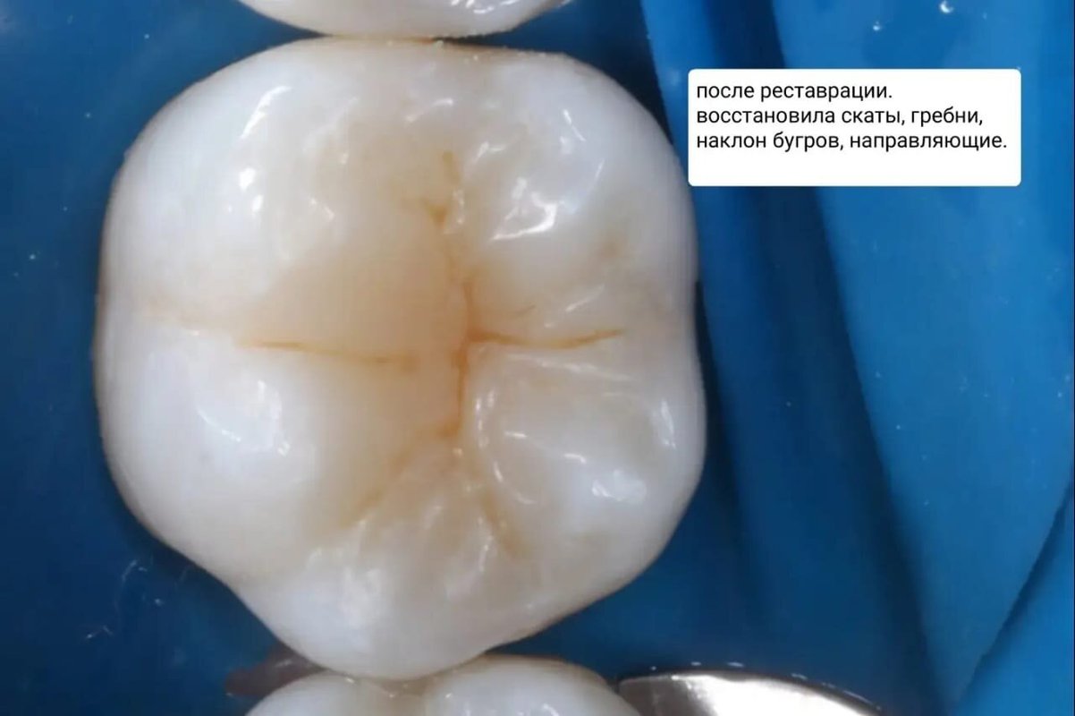 фотография работы Центра имплантации Терюховых на Никитской улице