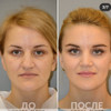 фото от пользователя Александра  в отзыве о враче Елене Викторовне Николаевой