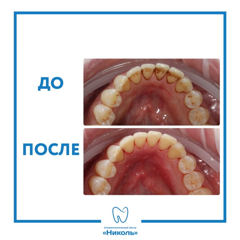 фотография работы Стоматологии Николь у метро Беговая
