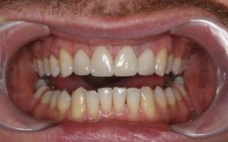 фотография работы врача Сергея Анатольевича Лабаня