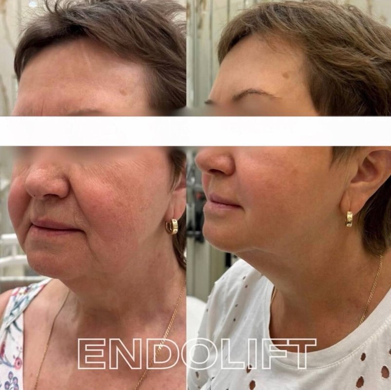 фотография работы Клиники современной косметологии Esteeskin Clinic